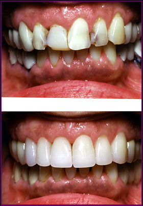 Cosmetic Dentistry Services1
