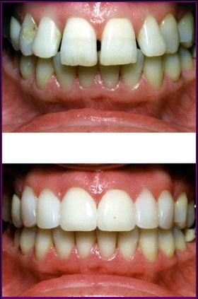 Cosmetic Dentistry Services2