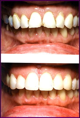 Cosmetic Dentistry Services3