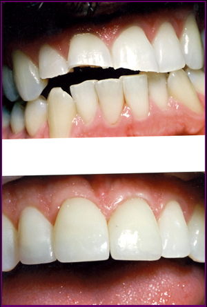 Cosmetic Dentistry Services4