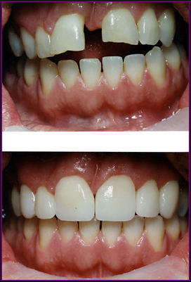 Cosmetic Dentistry Services5